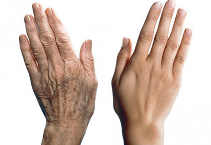 Лазерное омоложение