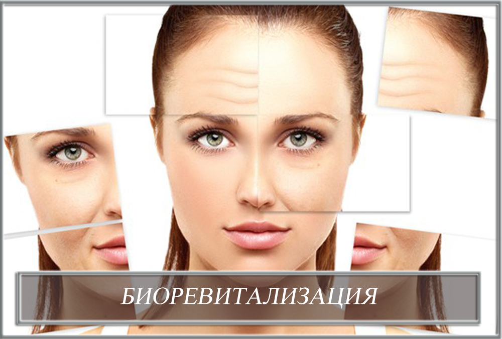 Биоревитализация