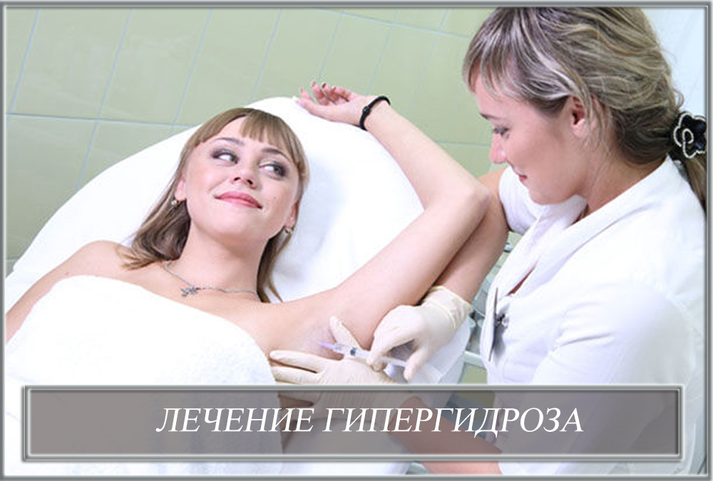 Лечение гипергидроза ботулотоксинами