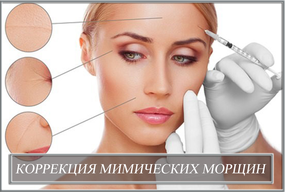 Коррекция мимических морщин