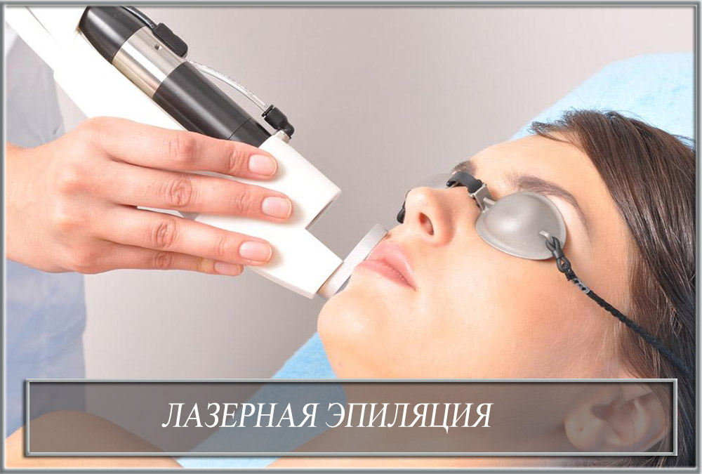 Лазерная эпиляция